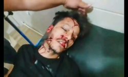 نقدی بر انتشار ویدئوی مجروح سقزی